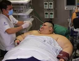 Pasó de 595 kilos en noviembre de 2016 a 304 kilos en 2018: World S Heaviest Man Goes Under Knife In Mexico News Emirates24 7