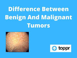 Read more to understand the difference between cancerous tumors and what you should be concerned about. Difference Between Benign And Malignant Tumors