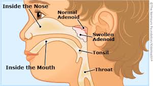 Search for kids body parts in these categories. Adenoids And Adenoidectomies For Kids Nemours Kidshealth