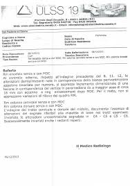 I disturbi motori possono corrispondere a placche situate sia nel cervello che nel midollo spinale. Sclerosi Multipla Riduzione Delle Lesioni Demielinizzanti Dopo Due Cicli Di Cura Mineral Test Mineral Test