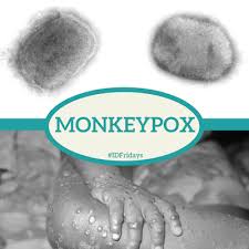 Monkeypox virus (mpxv) causes disease in both animals and humans. Infectious Disease Fridays Idfridays Week 1 Monkeypox