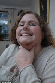 There is no scientific reason for increased facial hair growth related to pregnancy hormones. Movember 2012 Mother Who Has Tried To Hide Facial Fluff Since She Was A Teenager Grows Moustache For Charity Daily Mail Online