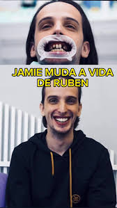 Jamie ofereceu uns dentes novos ao ruben ————————————————————————————  #jamie #ruben #dentes #meclinic #youtubeportugues #porugal