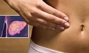 The liver is your largest internal organ. Fatty Liver Disease Non Alcoholic Symptoms Include Dull Pain Express Co Uk