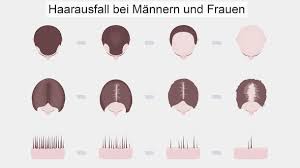 Fallen so viele haare aus, dass die haare sichtbar. Wieviel Haarausfall Am Tag Ist Normal
