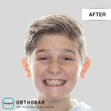 Introducing Orthobar