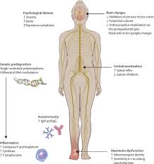 Image result for Pain Disorder