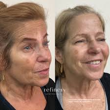 Refinery Aesthetics Wellness