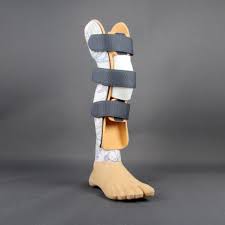 Angeborene Fehlbildungen Sanitatshaus Puttmann In Essen Beine Fusse Waden