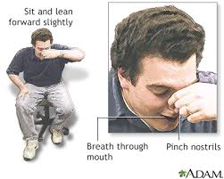 However, a dry nose is rarely a cause for concern, and a person can usually treat it themselves, by inhaling steam or by using a humidifier, nasal sprays, or nasal rinses. Nosebleed Information Mount Sinai New York