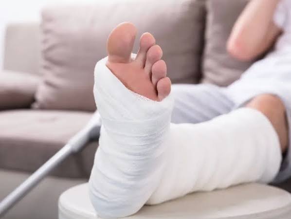 Nằm mơ thấy g&atilde;y ch&acirc;n l&agrave; điềm g&igrave;, con g&igrave; gi&uacute;p đổi vận?