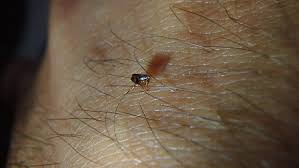 Fleas should be attacked as quickly as possible, hitting both the source and premises. What Do Fleas Look Like Pictures Of Fleas Eggs Larvae Bites