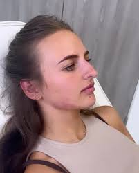 A subtle but noticeable...