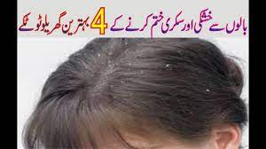 Apparently, akbar visited the saint to seek his blessing. Balo Ki Khushki Ya Sikri Khatam Kerne Ka Tarika Dandruff Treatment In Urdu By Easy Health786 Youtube