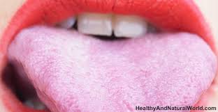 Here S Why You Have Bumps On Your Tongue With Images Bumps On Tongue Gum Health Lie Bumps On Tongue