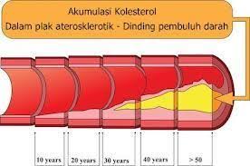 Hasil gambar untuk obat kolesterol di karawang