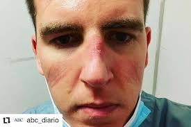 En Argentina, un testimonio de un médico llamado Marcelo Lemus se volvió  viral debido a que decidió renunciar a su cargo de doctor de urgencias  producto de “la irresponsabilidad de la gente”,