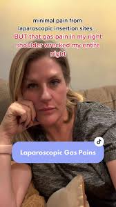 Gas Pain After Laparoscopic Surgery: My Experience