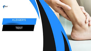 Image result for Ankle External Rotation Test