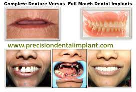 Pin On 01dental Emergency