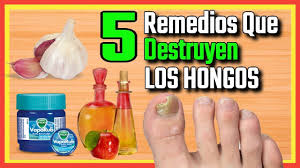 Hongos En Las Uñas De Las Manos Como Eliminarlos 5 Potentes Remedios Caseros Para Eliminar Los Hongos De Las Unas De Las Manos En 2020 Remedios Para Hongos En Los Pies Remedio Hongos Pies Eliminar Hongos De Las Unas