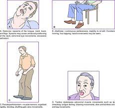 The chewing motion and constant saliva tricks your brain into thinking you're actually hungry. H Tardive Dyskinesia