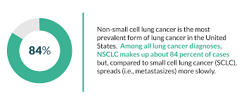 Glioblastoma is an aggressive cancer of the brain. Non Small Cell Lung Cancer Symptoms Diagnosis Treatment