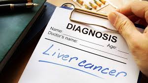 Liver Cancer Symptoms And Treatment Options What To Know