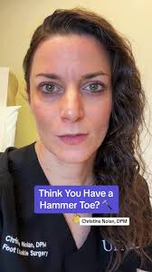 Think you have a hammer toe? Here are the signs to look for. #HammerToe  #FootPain #FootPainRelief