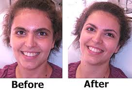Hold the string up to your eyebrow, as you make one circle larger and the other smaller, that middle part that is wound will grab hairs that is passes and remove them. Before After Photos How To Clean Up Your Brows For Spring Expert Ramy Gafni S Top 3 Favorite Brow Makeover Looks Beautystat Com