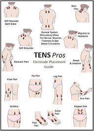 Tens Electrode Placement What You Should Know In 2020 Tens Unit Therapy Fibromyalgia Tens Electrode Placement