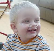 Wirral Calendar Girls bare all to help children with rare genetic lung  disorder