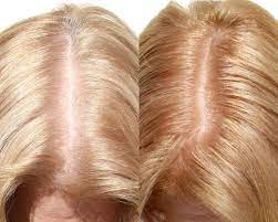 How To Get The Best Grey Coverage Grey Hair Coverage Strawberry Blonde Red Hair Going Grey