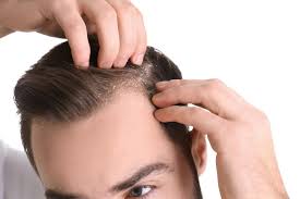 Here are some of the hair care tips to get rid of dandruff. A Guide To Dandruff Treatments At Home Head Shoulders Au