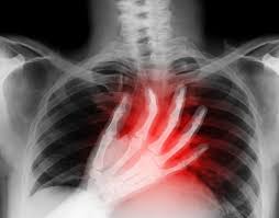 Pin On Medical Nursing Stuff