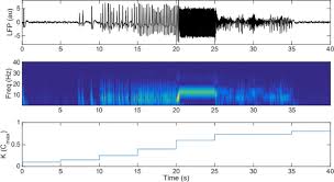 Scheduling the sst meeting a. 28th Annual Computational Neuroscience Meeting Cns 2019 Bmc Neuroscience Full Text