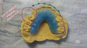 How To Replace A Broken Retainer Wire Youtube