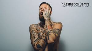 Here's what you should know before booking a tattoo removal if, like me, you want your ink completely removed, you should know that the skin that is left might not be flawless. For Laser Tattoo Removal Picoway Is The Way To Go Here S Why The Aesthetics Centre