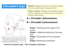 Choose from 500 different sets of flashcards about chvostek's sign on quizlet. Calcium Lecture For Medical Student Ppt Download