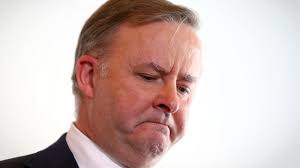 And that's what he picks to comment on? Anthony Albanese S Very Personal Reason For Opposing A Gay Marriage Plebiscite