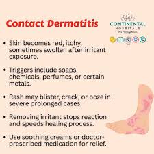 Image result for dermatitis contacta toxica