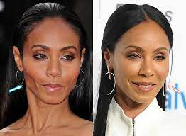 28.09.2021 · jada pinkett smith and willow smith want some more junk in their trunks…or at least they considered it at one point. Has Jada Pinkett Smith Had Plastic Surgery Before After 2021
