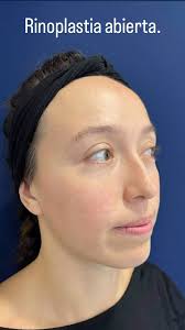 Zenith Plastic Surgery