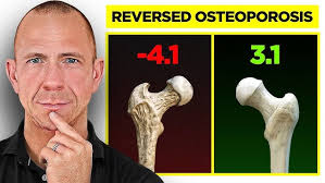 Exercise for Osteoporosis, Osteopenia & Strong Bones