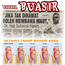 Kami mempunyai solusi terbaik untuk menyembuhkan penyakit gatal yang sedang anda derita dengan obat. Anieshauma Tercari Cari Cara Hilangkan Buasir Benjolan Keluar Dari Dubur Gatal Pada Dubur Kalau Berak Keluar Darah Rasa Takut Nak Membuang Jika Ini Berlaku Bermakna Anda Dalam Bahaya Dah Pelbagai