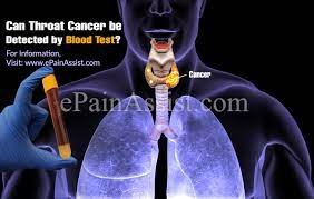With the exception of blood cancers, blood tests generally can't absolutely tell whether you have cancer or some other noncancerous condition, but they can samples collected for cancer blood tests are analyzed in a lab for signs of cancer. Can Throat Cancer Be Detected By Blood Test Is Cancer In Throat Deadly