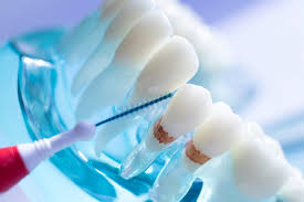 This marks benco dental's fourth acquisition in the california market in the past three years. How To Manage Food Traps Between Your Teeth Enamel Republic