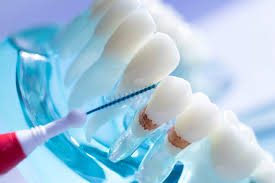We take pride in our mission to meet community needs across the state. How To Manage Food Traps Between Your Teeth Enamel Republic