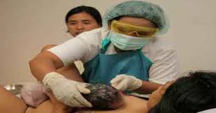 Image result for inisiasi menyusui dini