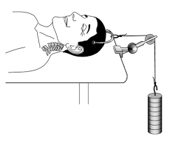 The ultimate track system 103 brown st, p.o. Fractures Plan Implementation Splinting Traction Flashcards Memorang